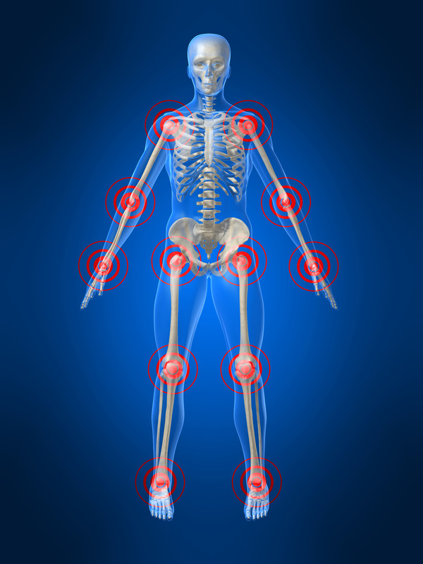 Quita el dolor de Artritis y Coyontruas Dolor de Artritis en Articulaciones y Coyonturas
